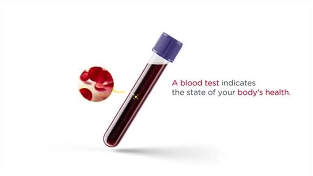 totalenergies_lubanac (відео)